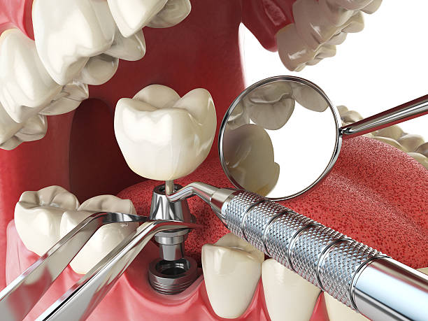Best Root Canal Emergency Dentist  in Mulgee, OK